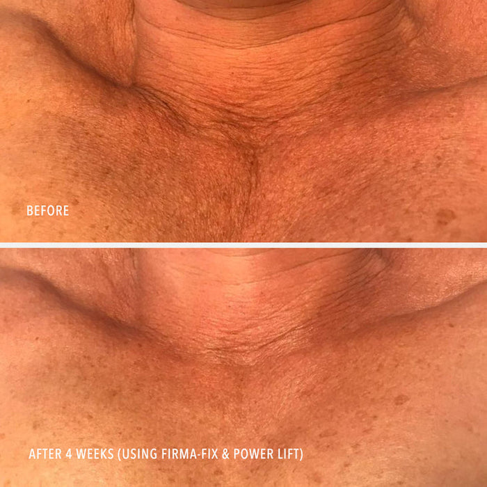 FIRMA-FIX NECTAR - Lifting Neck & Décolleté Serum