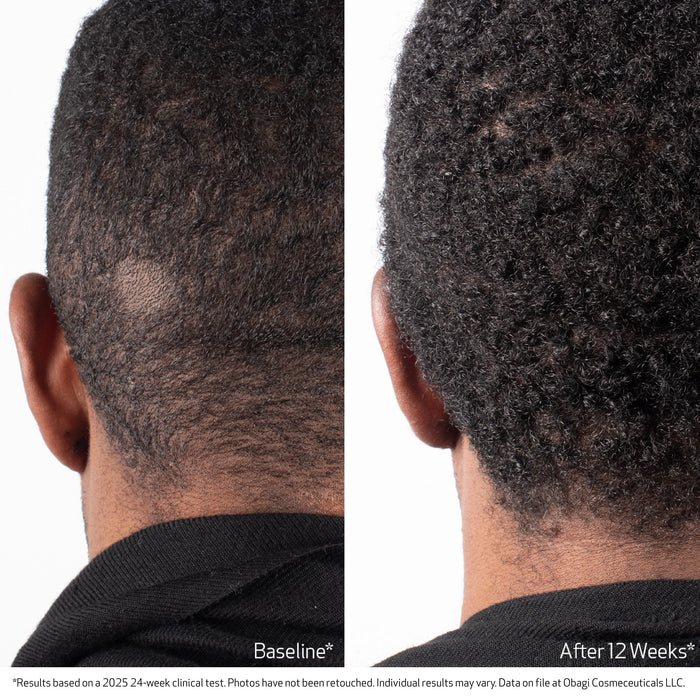 BIOSTIM™ SCALP SERUM