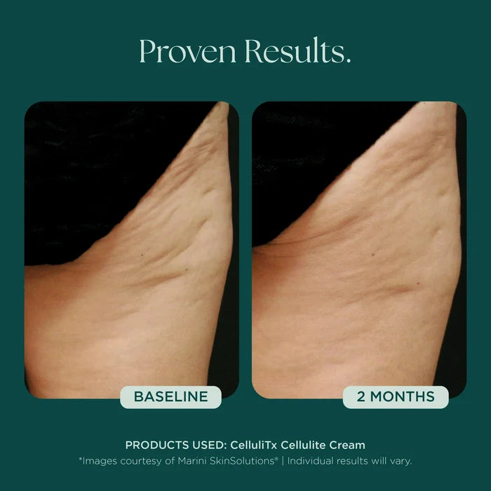 CelluliTX Cellulite Cream