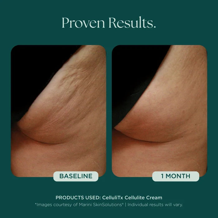 CelluliTX Cellulite Cream