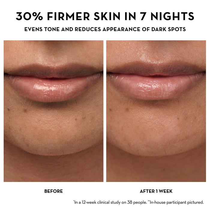 Before and After image after 1 week of using Dewtopia 5% Acid Firming Night Crème, reading: 30% firmer skin in 7 nights, evens tone and reduces appearances of dark spots (*In a 12-week clinical study on 38 people).