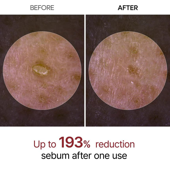 Dr. Melaxin Peel Shot Exfoliating White Rice Ampoule 80Ml