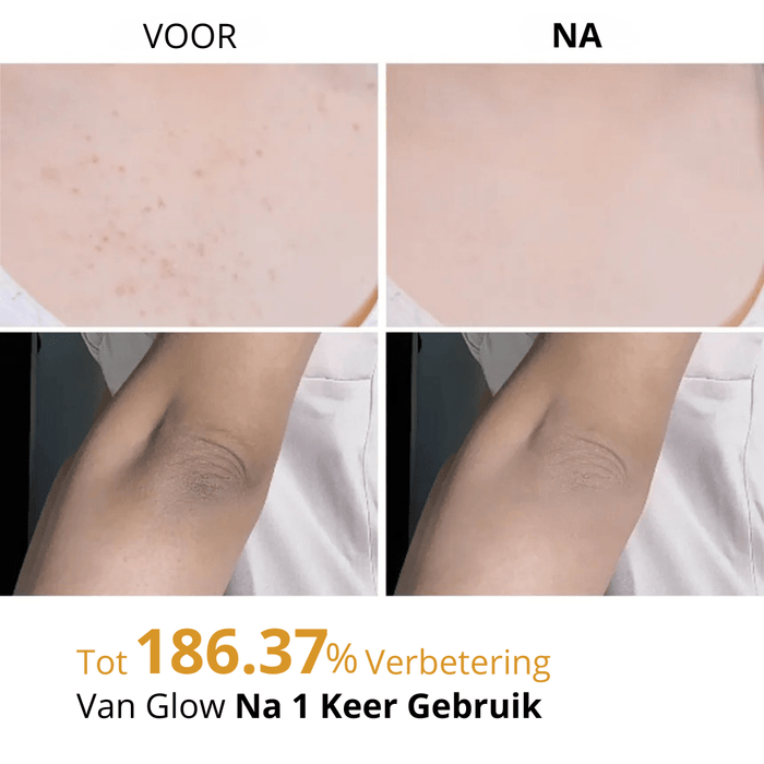 Dr. Melaxin | Peelshot Turmeric Spray - skin28