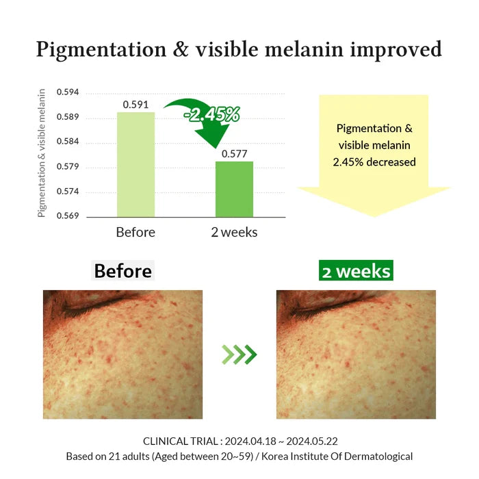 Dr.Althea Gentle Vitamin C Serum 30Ml