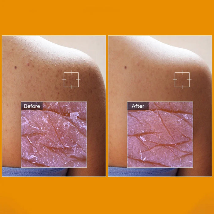 [Dr.Melaxin] TX-Kojic Acid Turmeric Toner Pad 190ml 70EA - Ballagrio