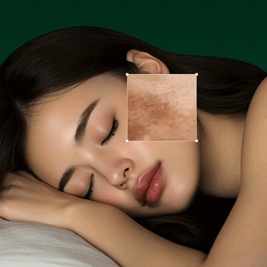 [Easydew] DW-EGF Mela Overnight Melting Cream 50g - Ballagrio