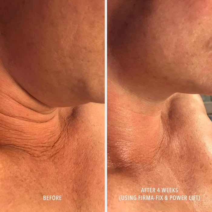 FIRMA-FIX NECTAR - Lifting Neck & Décolleté Serum