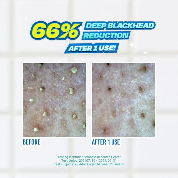 Jumiso Blackhead Melting Softener & Cotton Pad   Special Kit