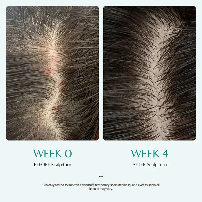 Lilyeve Scalp:Turn Cica PDRN Brush Ampoule 100Ml