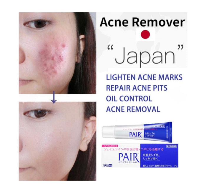 Lion Pair Acne Cream 24g