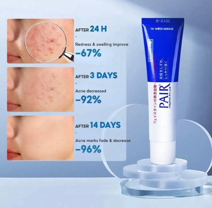 Lion Pair Acne Cream 24g