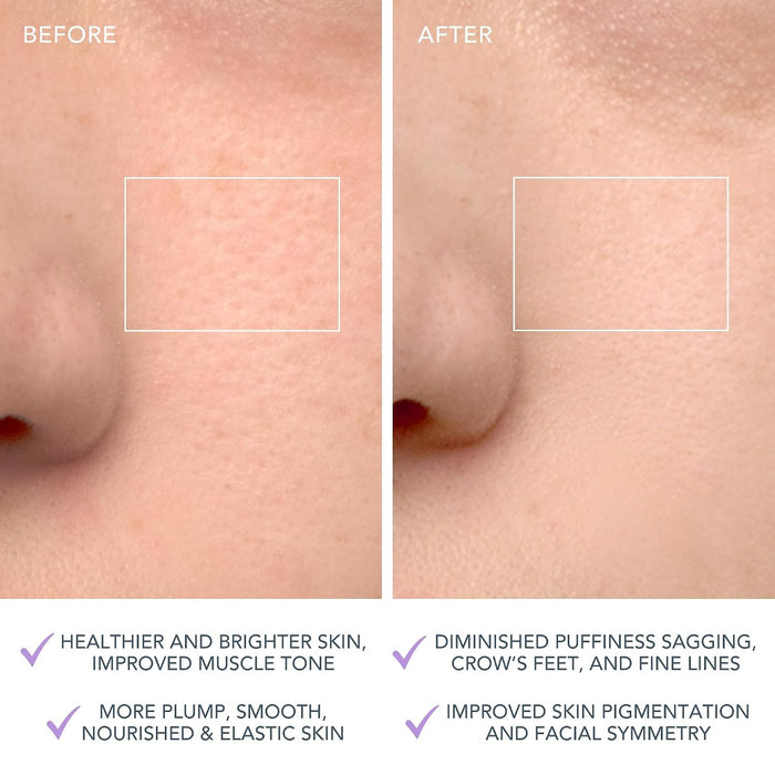 LUNA 4 Facial Cleansing Device for Sensitive Skin