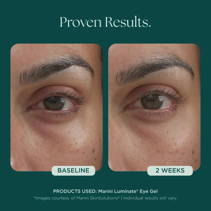 Marini Luminate® Eye Gel