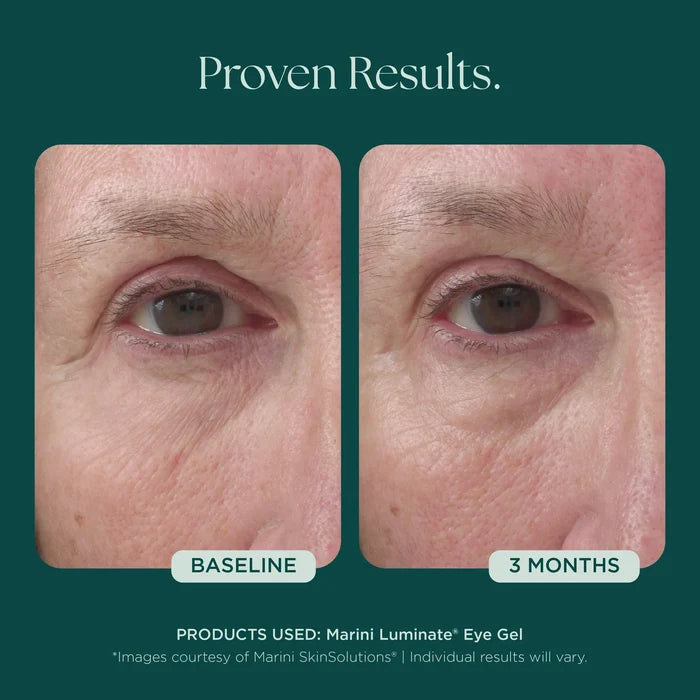 Marini Luminate® Eye Gel