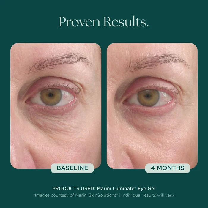 Marini Luminate® Eye Gel