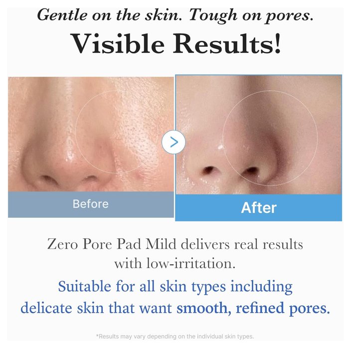 MEDICUBE Zero Pore Pad Mild 70ea