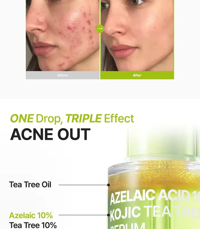 Purito Azelaic Acid 10 Kojic Tea Tree Serum 30Ml