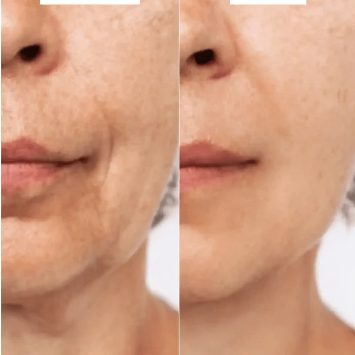 Before and after comparison of a woman's face with visible skin texture differences.