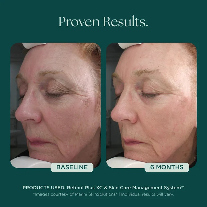 Retinol Plus