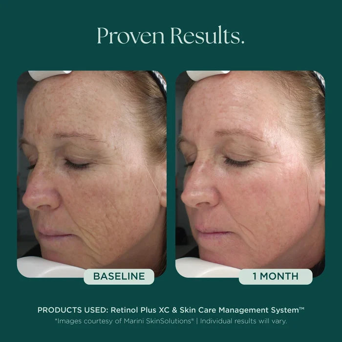 Retinol Plus