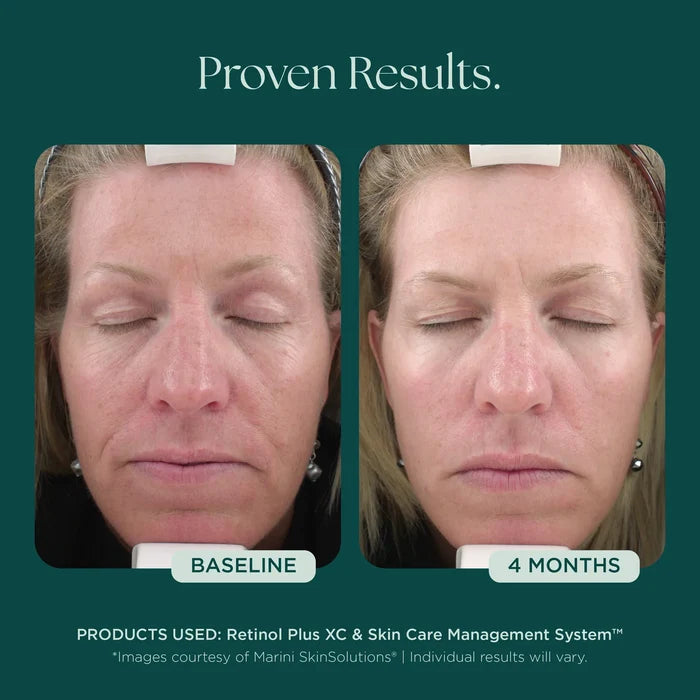 Retinol Plus