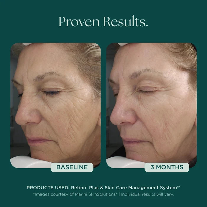 Retinol Plus