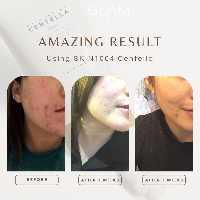 SKIN1004 Madagascar Centella Travel Kit 5 Types | GlamTouch UK