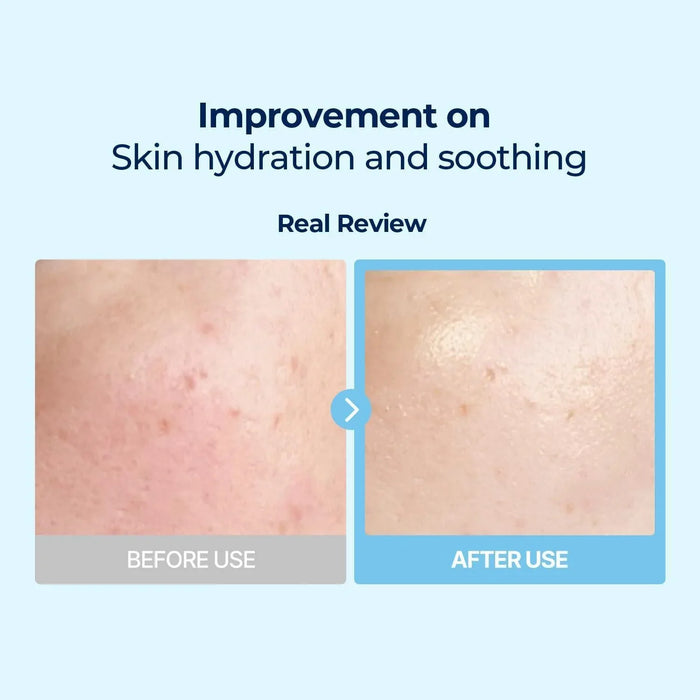 [Torriden] DIVE-IN Low Molecule Hyaluronic Acid Multi Pad 160ml 80EA Torriden