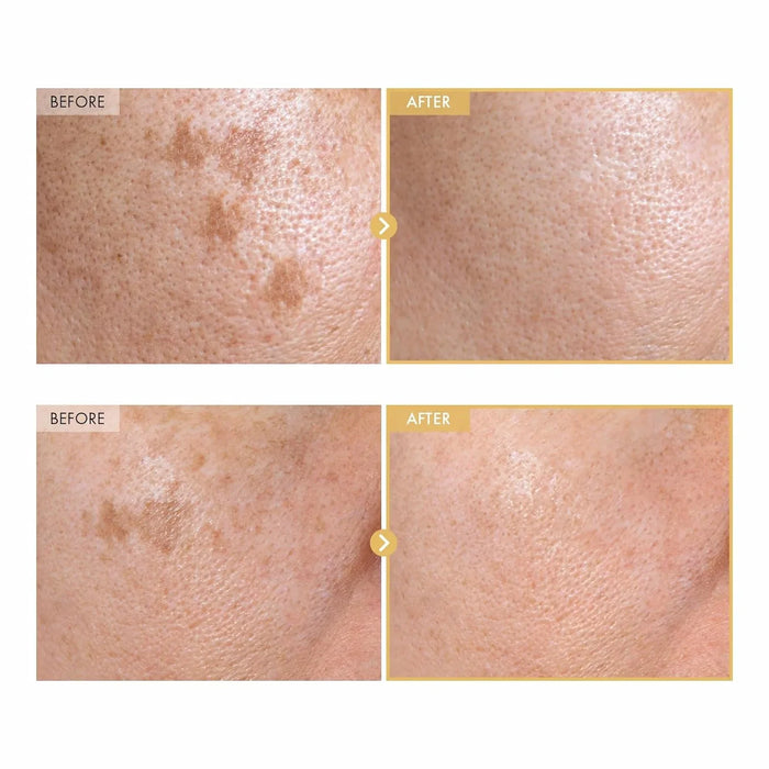 [TOSOWOONG] Black Snail Ginseng Serum 30ml - Ballagrio