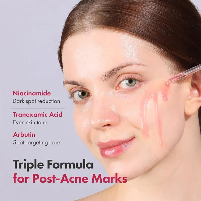 [TOSOWOONG] Niacinamide 10% TXA 4% Serum 33ml - Ballagrio