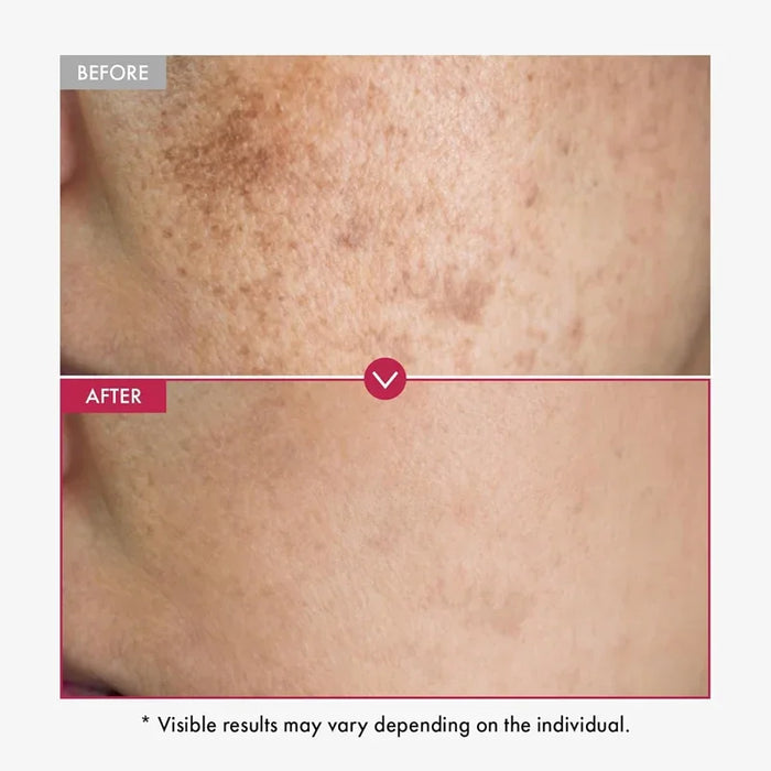[TOSOWOONG] Niacinamide 10% TXA 4% Serum 33ml - Ballagrio