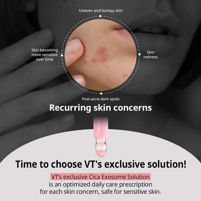 VT Azelaaic Acid A1 Calming Ampoule 30Ml