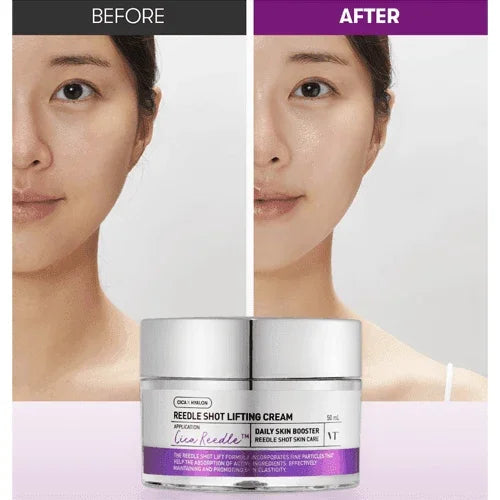 [VT Cosmetics] Reedle Shot Lifting Cream 50ml - Ballagrio